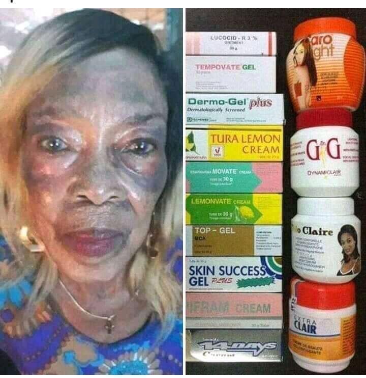 🇬🇭🇷🇼🇹🇿🇨🇮🇸🇸🇰🇪🇳🇬Skin Lightening Bans Across Africa: Laws on Paper, Products on Shelves